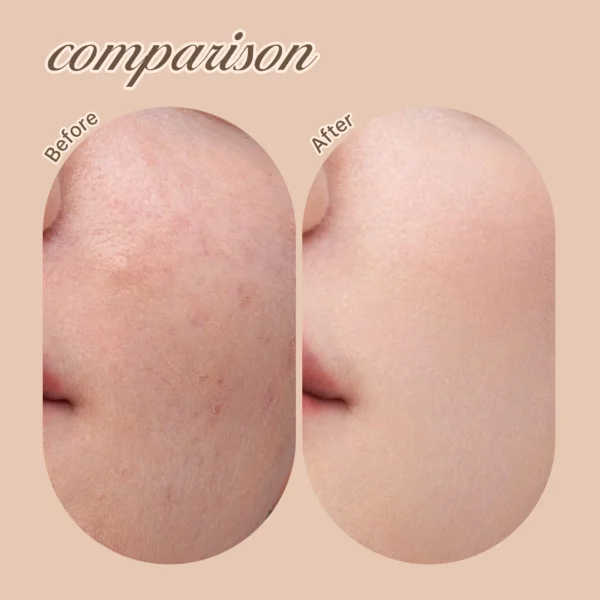 Correcteur liquide 6 teintes – Anticernes, anti-imperfections, fond de teint couvrant & hydratant – Image 14